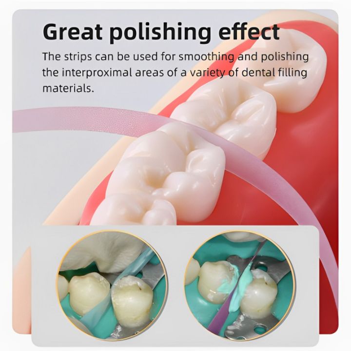 Dental%20Polishing%20Strip%20Roll%20Resin%20Tooth%20Grinding%20Sanding%20Teeth%20%204mm*6m%20-%20Image%204