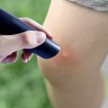 Electronic Mosquito Bite Pen For Itching Bite Insect Mosquito Relieve Adult Children Anti-itch Physical Itch Stick Stop Pen. 