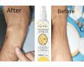 Fairy's Queen Hair Removal Spray 100ml, For Legs, Bikini Arms & Under Arms, No Bad Smell, For Man & Women. 