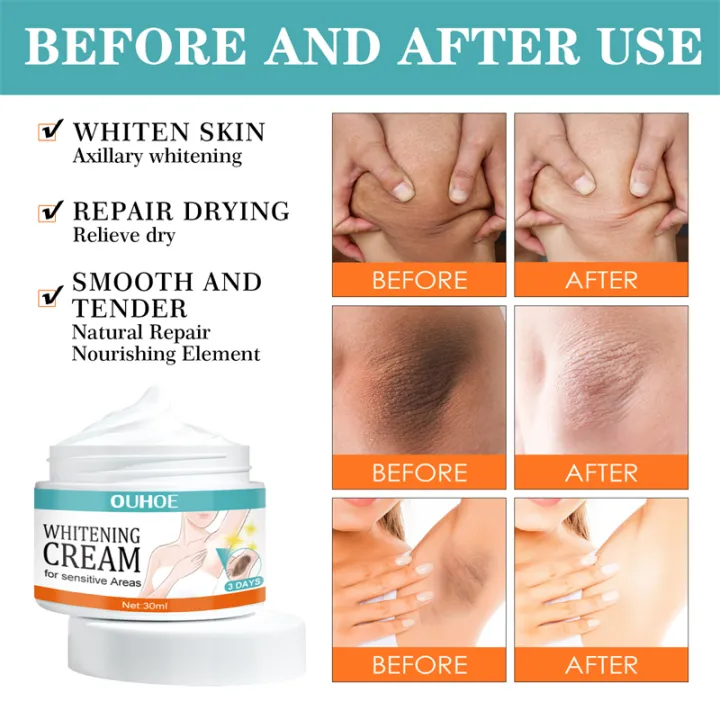 Facial%20&%20Body%20Whitening%20Cream%20for%20Brightening%20&%20Spot%20Removal%20-%20Moisturizing%20Skin%20Lightener%20for%20Sensitive/Mixed/Oily%20Skin%20-%20Image%204