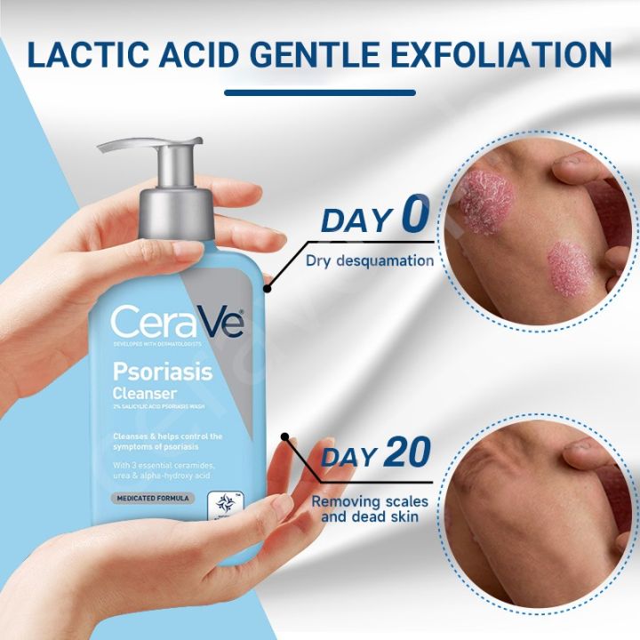 C%C3%A8raV%C3%A8%20Cleanser%20for%20Psoriasis%20Treatment%20Itch%20Relief%20&%20Exfoliation%20237ML%20-%20Image%206