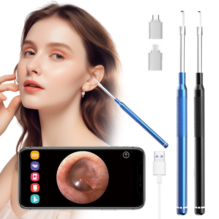 Smart Ear Cleaner Endoscope 3 in 1 Digital Endoscope Earwax Cleaner