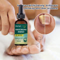 7DAYS Repair Nail Fungus Treatments Essence Foot Care Serum Toe Nails Fungal Removal Gel Anti-Infection freshfeet. 