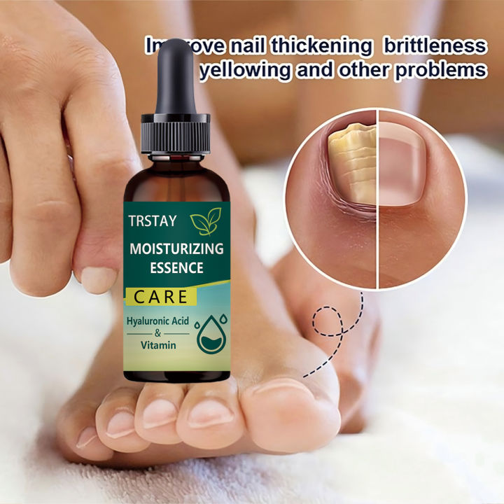 7DAYS%20Repair%20Nail%20Fungus%20Treatments%20Essence%20Foot%20Care%20Serum%20Toe%20Nails%20Fungal%20Removal%20Gel%20Anti-Infection%20freshfeet%20-%20Image%205