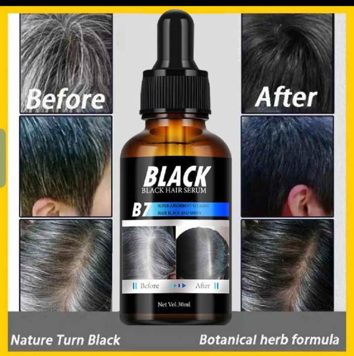 MOIKA%20Black%20Hair%20Essence%20%7C%20Anti-Hair%20Loss,%20Growth%20Booster,%20Revitalize%20with%20Lustrous%20Black%20Shine,%20Professional%20Hair%20Care%2030ml%20-%20Image%206
