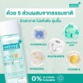 Smooth E acne-5 pore clear Whitening Toner smooth e acne clear Whitening Toner [3 bottles] 4in1 Toner reduce acne problem. 