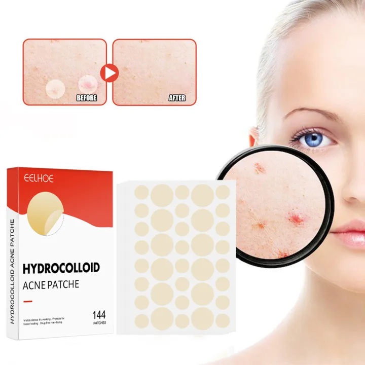 144pcs/set%20Face%20Skin%20Care%20Acne%20Pimple%20Patch%20Invisible%20Professional%20Healing%20Absorbing%20Spot%20Sticker%20Covering%20Acne%20for%20Men%20Women%20-%20Image%203