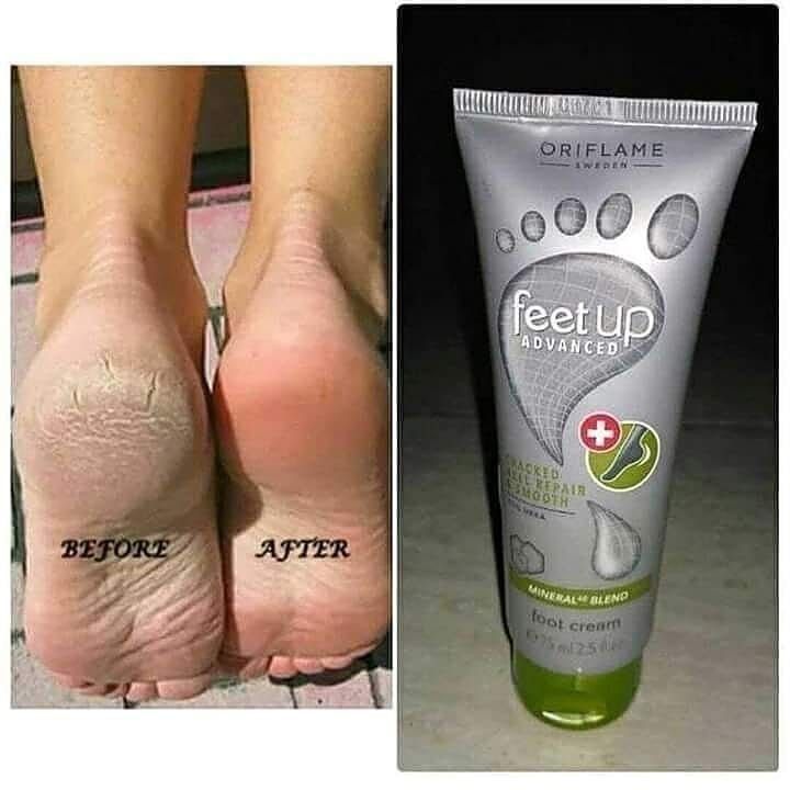 "Feet%20Up%20Advanced%20Cracked%20Heel%20Repair%20Cream%20by%20Oriflame"%20-%20Image%207