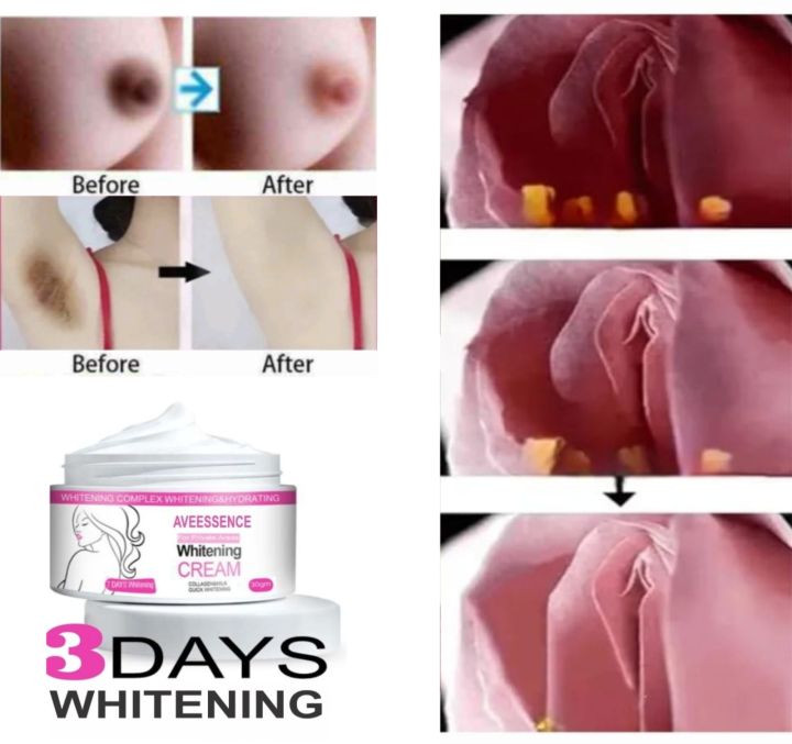 Aveessence%20private%20parts%20whitening%20cream%20for%20dark%20intimate%20areas%20-%20Image%203