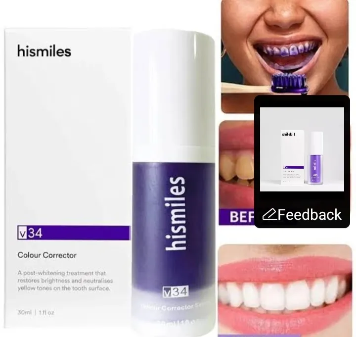 HiSmile%E2%84%A2%20Teeth%20Whitening%20Kit%20%E2%80%93%20Professional%20LED%20Whitening%20System%20for%20Brighter%20Smile%20(Safe%20&%20Effective%20Formula)%20-%20Image%203