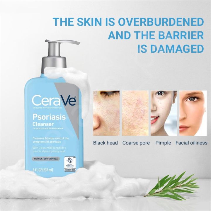 C%C3%A8raV%C3%A8%20Cleanser%20for%20Psoriasis%20Treatment%20Itch%20Relief%20&%20Exfoliation%20237ML%20-%20Image%208
