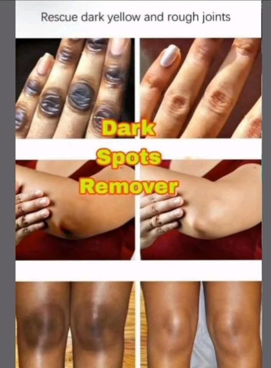 Lemonvate%20Cream%20-%20Image%207