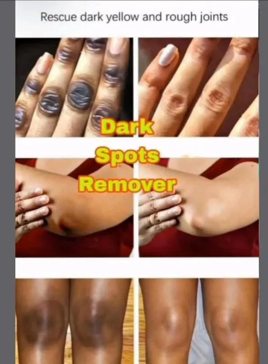 Lemonvate%20Cream%20-%20Image%207