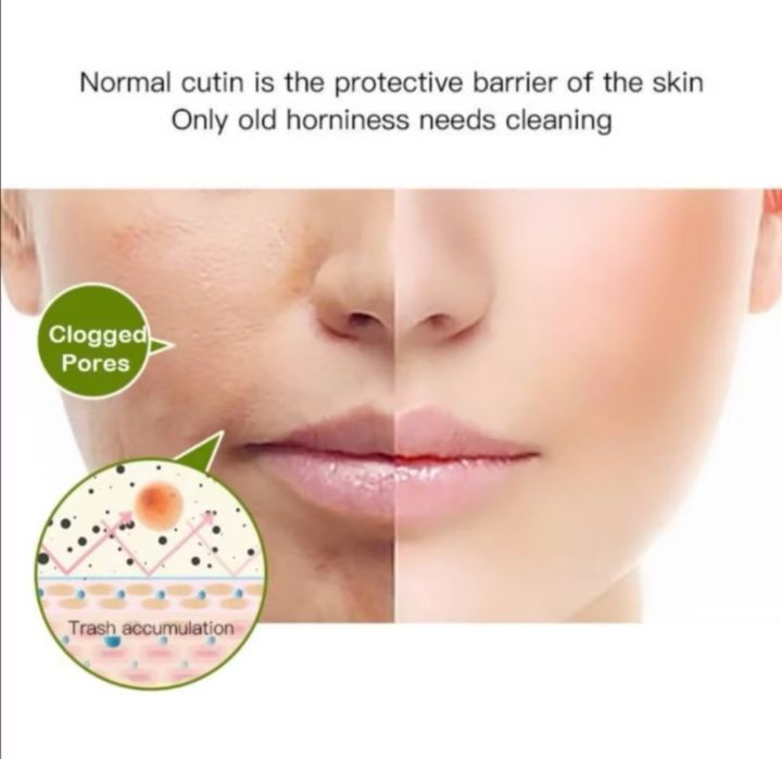 Andorheal%20Yellow%20Sugar%20Exfoliating%20Facial%20Scrub%20Deep%20Cleansing%20-%20Image%205