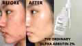 The Ordinary Alpha Arbutin 2% + HA. 