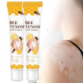 Original Vitigo Bee Venom Care Cream for Vitiligo, Pigmentation & White Spots | Skin Repair & Melanin Restoration Cream | Natural Herbal Treatment for Uneven Skin Tone | Moisturizing Anti-Spot Whitening Cream – 20g | Gadget Xpres. 