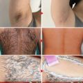 2 Minutes Painless Fast Hair Removal Spray Hair Growth Inhibitor Arm Armpit Leg Permanent Depilatory for Men Women Repair Care.