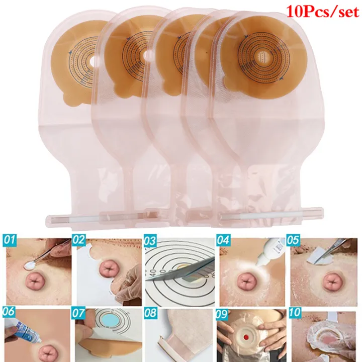 10Pcs%20Colostomy%20Bags%2025-60mm%20Stoma%20Pouch%20Bags%20One-piece%20Open%20Clip%20Ostomy%20Bags%20-%20Image%202