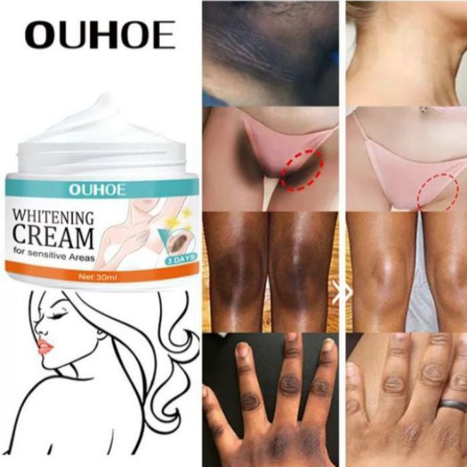 Whitening cream for sensitive areas underarm and private parts of body men's and woman