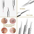 German Ultra-fine No. 5 Cell Pimples Blackhead Clip Tweezers Beauty Salon Special Scraping & Closing Artifact Acne Needle Tools. 