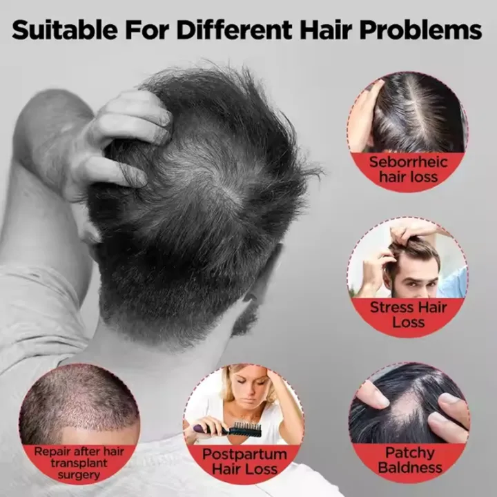 LED%20Red%20Light%20Therapy%20Cap%20Hair%20Growth%20Helmet%20Diode%20Laser%20Hat%20Light%20Therapy%20Cap%20for%20Hair%20Regrowth%20and%20Hair%20Loss%20Treatment%20-%20Image%202