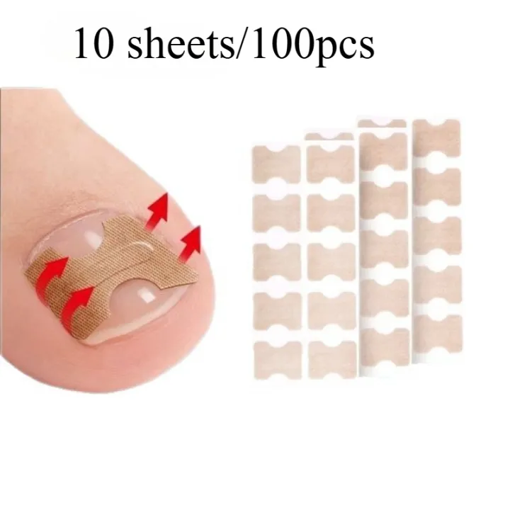 professional%20Nail%20Correction%20Stickers%20Ingrown%20Toenail%20Corrector%20Patches%20Paronychia%20Treatment%20Recover%20Corrector%20Pedicure%20Tools%20-%20Image%207