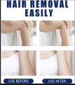 Hair Removal Crystal,Epilator Painless Hair Removar. 