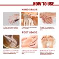 Horse Oil Hand and Foot Care Cream - Moisturizing and Anti-peeling Cream for Dry, Cracked Hands and Feet. 