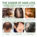 Rosemary Oil Hair Growth Essential Coconut Oil Improve Hair Loss And Nourishes Strengthen Hair Roots Scalp Treatment Hair Care. 