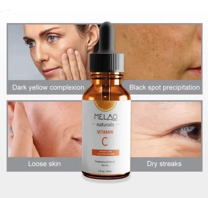 MELAO%20Naturals%2020%25%20Vitamin%20C%20and%20Hyaluronic%20Acid%20Serum%20-30ml%20-%20Image%202