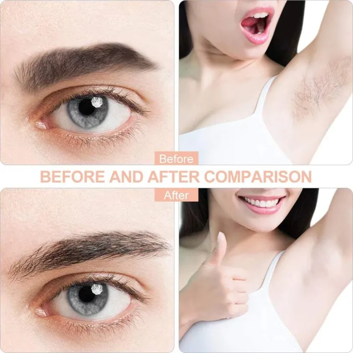 Rechargeable%20Flawless%20Facial%20Hair%20Remover%20Machine%20-%20Image%202