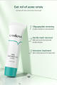 Authentic LANBENA Acne Treatment Gel -20g. 