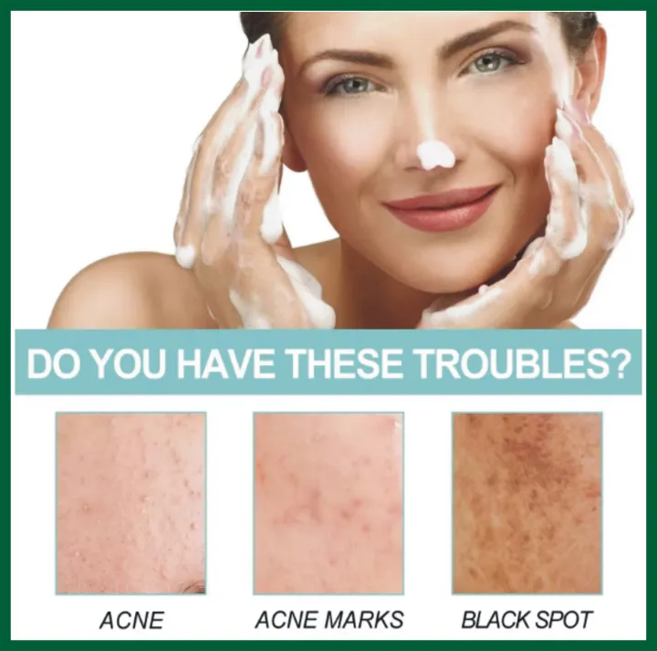 FORT%20Acne%20Clear%20Face%20Wash%20-%20Salicylic%20Acid%20Cleanser%20for%20Oil%20Control%20&%20Anti-Acne%20%7C%20Acne%20skin%20care%20products%20Reduces%20Blackheads%20&%20Whiteheads%20100ml%20-%20Image%202