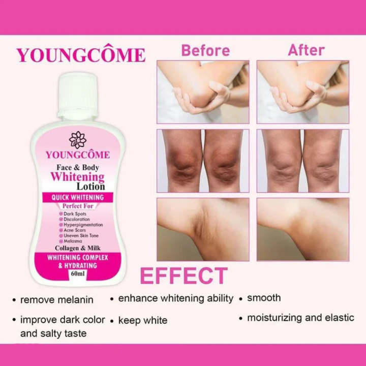 60ml%20Young%20Come%20Face%20Body%20Whitening%20Lotion%20-%20Image%202