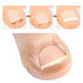 20-100pcs Adhesive Toenail Patch Ingrown Toe Nail Correction Sticker Foot Corrector Pedicure Health Care Tools Toe Treatment Pad freshfeet.