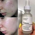 Niacinamide 10% + Zinc 1% -[30ml]. 