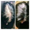 Update Organic Hair Fall Oil Treatment for strong,soft, shiny & wavy hair - 175ml.