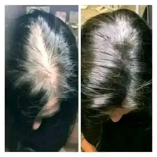 Update%20Organic%20Hair%20Fall%20Oil%20Treatment%20for%20strong,soft,%20shiny%20&%20wavy%20hair%20-%20175ml%20-%20Image%205