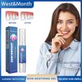 Damaged Gum Repair Care Gel Relieve Sore Gums Allergy Deep Cleaning Teeth Stains Tartar Serum Dental Caries Tootaste 4ml. 