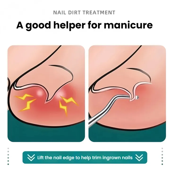 Stainless%20Steel%20Toenail%20Cleaner%20Repair%20Tools%20Curved%20Nail%20Spoon%20Removing%20Dirt%20Anti%20Slip%20Grip%20Foot%20%20Deep%20Cleaning%20of%20Nail%20Grooves%20-%20Image%205