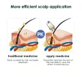 Scalp Applicator & Massage Comb – Portable Mini Tool for Hair Loss & Scalp Care. 