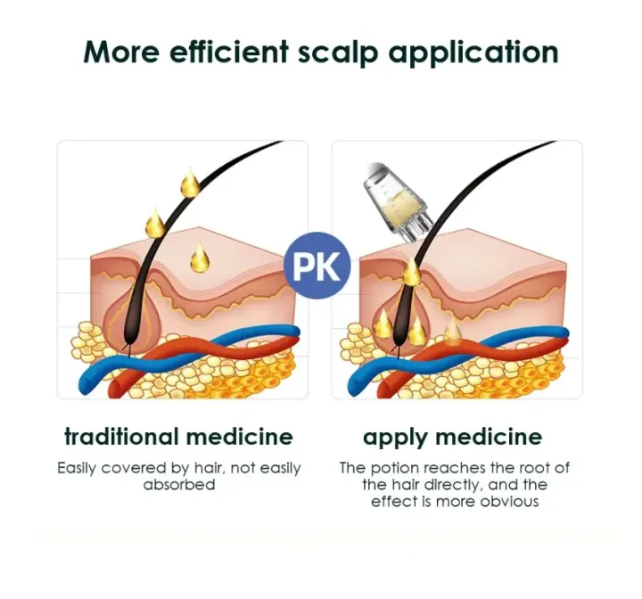 Scalp%20Applicator%20&%20Massage%20Comb%20%E2%80%93%20Portable%20Mini%20Tool%20for%20Hair%20Loss%20&%20Scalp%20Care%20-%20Image%205