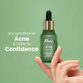 Rivaj acne treatment face serum 30ml. 