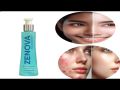 Zenova Cleanser Face Wash 100ml – 100% Original Anti-Bacterial Face Wash for Acne-Prone Skin | Oil Control & Deep Cleansing Formula | Best Face Wash for Oily & Sensitive Skin | Daily Use Gentle Cleanser for Men & Women. 
