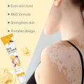 Original Vitigo Bee Venom Care Cream for Vitiligo, Pigmentation & White Spots | Skin Repair & Melanin Restoration Cream | Natural Herbal Treatment for Uneven Skin Tone | Moisturizing Anti-Spot Whitening Cream – 20g | Gadget Xpres. 