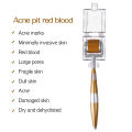 ZGTS 192 Titanium Derma Roller Micro Needles System Dermaroller Mesotherapy For Facial 0.2/0.25/0.3mm Needles Length Mesoroller. 