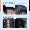 Hair Serum Bai Hei Ke. 