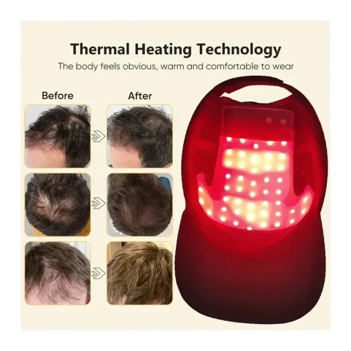 LED%20Red%20Light%20Therapy%20Cap%20Hair%20Growth%20Helmet%20Diode%20LaserHat%20Light%20Therapy%20Cap%20for%20Hair%20Regrowth%20and%20Hair%20Loss%20Treatment%20-%20Image%204