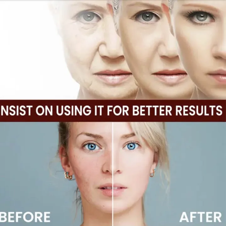 White%20Rice%20Face%20Whitening%20Cream%20Remove%20Dark%20Spots%20Fade%20Freckle%20Melanin%20Anti%20Wrinkle%20Aging%20Moisturizing%20Brighten%20Skin%20Care%20-%20Image%207