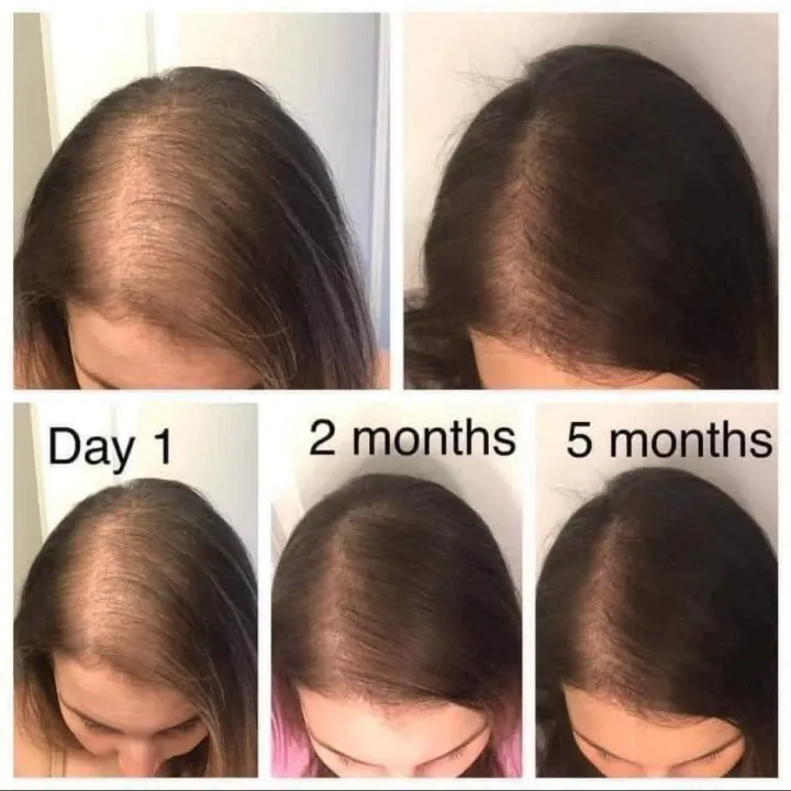 Mielle%20Rosemary%20Mint%20Scalp%20&%20Hair%20Strengthening%20Oil%20-%20Image%204